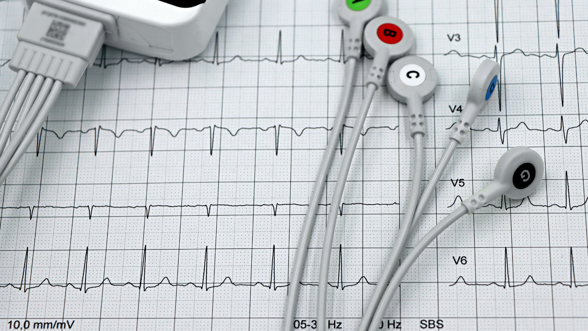 Attrezzature Cardiologiche