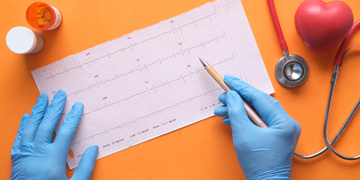 Tracciato ECG con battito irregolare che illustra un'aritmia cardiaca
